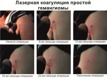плями