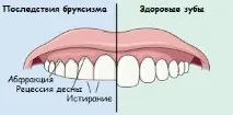 Дитина скрипить зубами уві сні. можна
