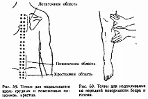 терапия