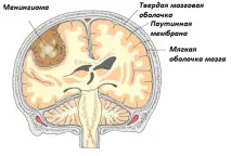 зору