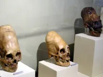 Бодімодифікація катування красою (8 фото) катування