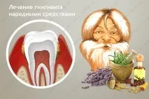 Лікування гінгівіту народними засобами, лікування в домашніх умовах у дорослих та дітей лікування