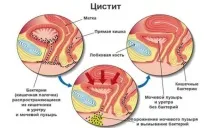 менструация