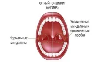 сироп