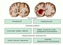характеристики