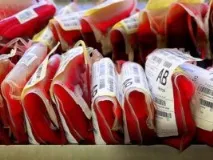 Методика проб на сумісність крові під час переливання проб