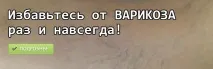 Чи можна народжувати при тромбозі глибоких вен народити з тромбофлебітом нижніх вен Лікування варикозу народити