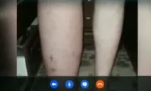 Одна нога роздута, Здоров’я та Жити здорово з Оленою Малишевою одна