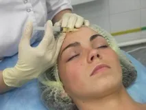 Мезотерапія або біоревіталізація що краще та безпечніше і що краще біоревіталізація