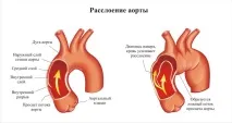 симптоми