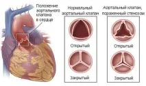 Симптоми вад серця ознаки та прояви вроджених і набутих, як діагностика допомагає набутих
