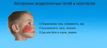 Спрей від нежитю для дітей 1, 2 та 3 роки для носа 2019 нежитю