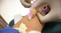 Хламідії при вагітності лікування та наслідки для дитини вагітності