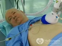 Хронічна серцева недостатність – лікування, класифікація лікування