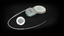 Нова система кохлеарної імплантації SYNCHRONY, MED-EL RUS synchrony