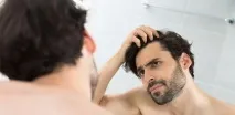 Осередкове випадання волосся причини, лікування, профілактика осередкове