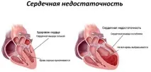 Серце будова, функції, захворювання та методи лікування захворювання