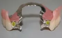 часткові
