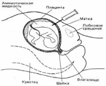 наследствени