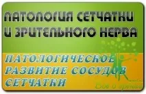 сітківки