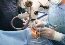 Папілома на оці, лікування, видалення папіломи на очах, під оком лікування
