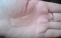 гель