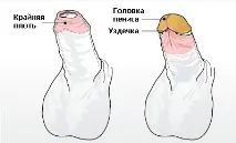 уролог