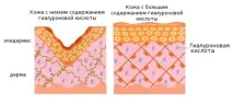 молодості