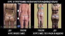 ІнфоТаганрог - Лікувально-оздоровчий центр «Івушка» лікувально-оздоровчий