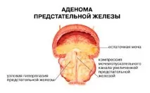 засобами