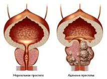 лікувати