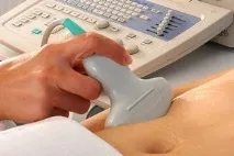 Препарати для стимуляції овуляції, схеми лікування безпліддя схеми