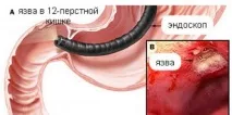 умовах