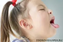 Коклюш у дітей коклюш