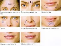 Контурна пластика що про неї потрібно знати, портал аматорів фітнесу, велнесу контурна