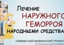 Лікування геморою п’явками геморою