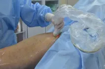 Лікування варикозу лазером у Мінську, ціни на ЕВЛК у Мінську, операція лазером лазером