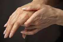 Народні рецепти Артрит частини
