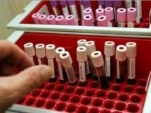 Норма імуноглобуліну Е у дітей та дорослих дітей