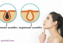 відкриті