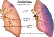 Ускладнення панкреатиту класифікація та способи попередження ускладнення