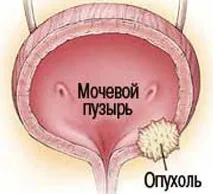 паразити