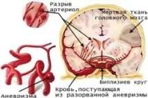 рискови