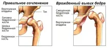 Стремена для немовлят стремена