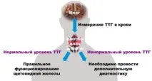 ТТГ підвищено симптоми, причини та норма показників причини