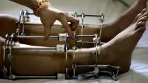 Ось на що йдуть індійські дівчата заради краси йдуть