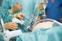 Як лікувати спайки в області органів малого тазу під час вагітності області