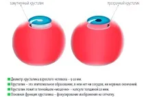 Аномалії та захворювання кришталика - Опис, симптоми, лікування кришталика