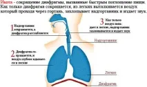 Що таке гикавка, методи запобігання гикавці запобігання