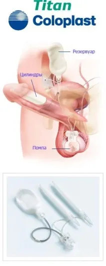 Фалопротези Колопласт (Coloplast) трикомпонентні, пластичні coloplast